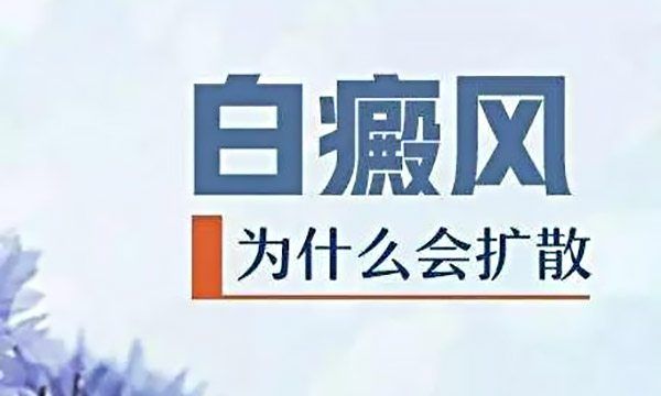 春季该如何预防白斑扩散呢?